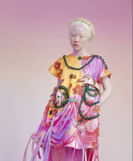 9x trở thành người mẫu bạch tạng đầu tiên tại Việt Nam: Từ cô bé chạy trốn ánh mặt trời đến Công chúa tuyết được các tạp chí thời trang hàng đầu săn đón - Ảnh 2.