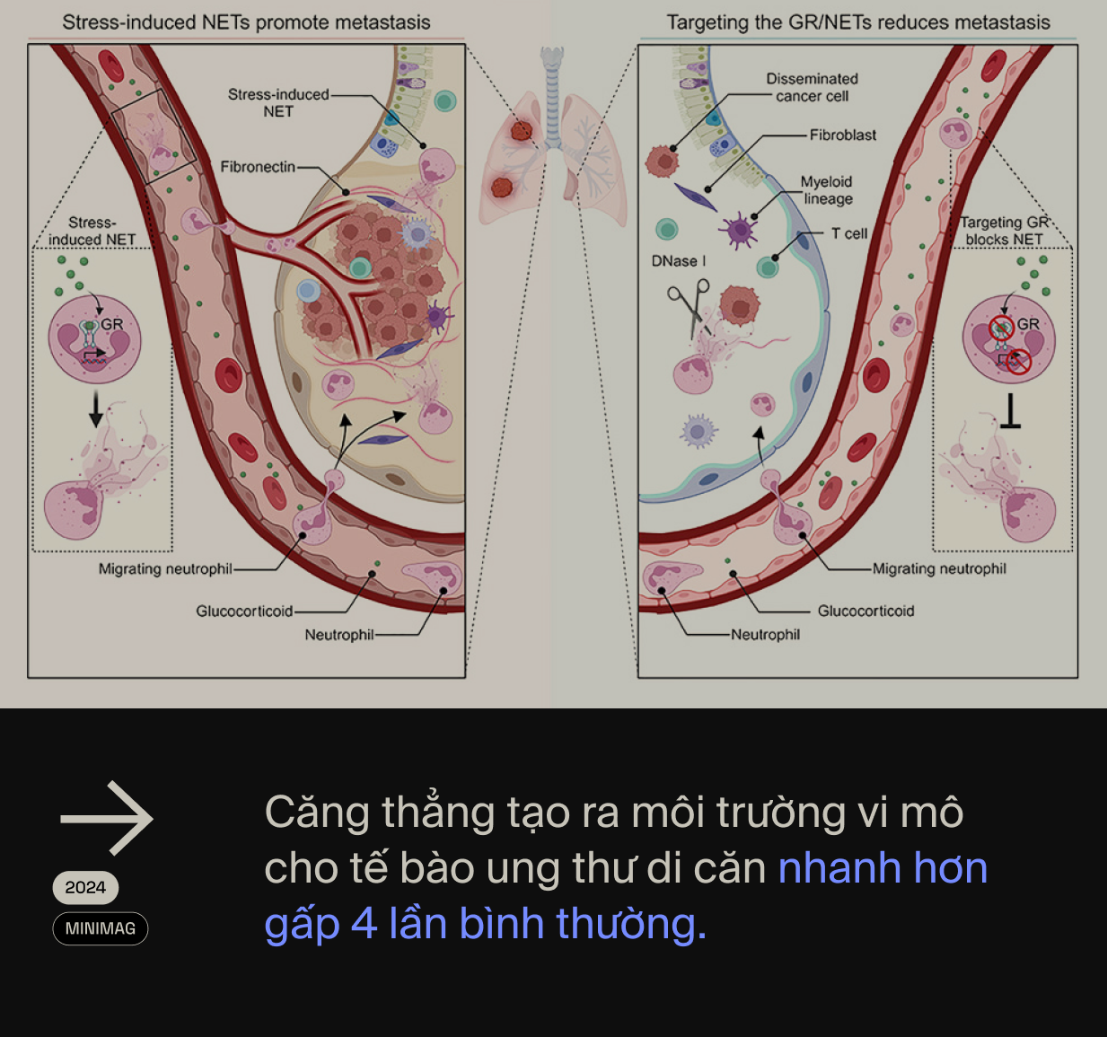 Ai đã "phát minh" ra stress: Tác nhân của 80% bệnh tật trên đời, bao gồm cả ung thư?- Ảnh 18.