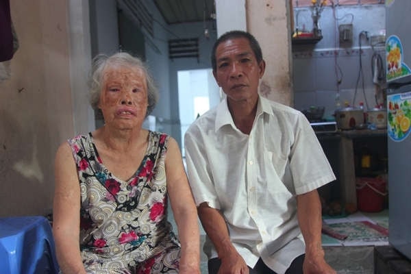 Chuyện về cô gái napan Bài 2: Người đàn ông trẻ và buổi hỏi vợ nhớ đời tại ủy ban phường