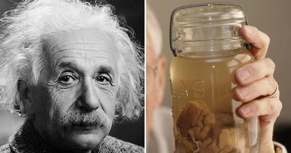 Bộ não của Einstein có gì đặc biệt mà bị cướp "trắng trợn" khi ông qua đời?