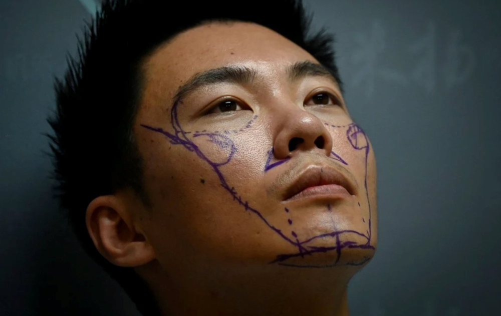 Ngày càng nhiều đàn ông Trung Quốc phẫu thuật thẩm mỹ để thay đổi cuộc sống