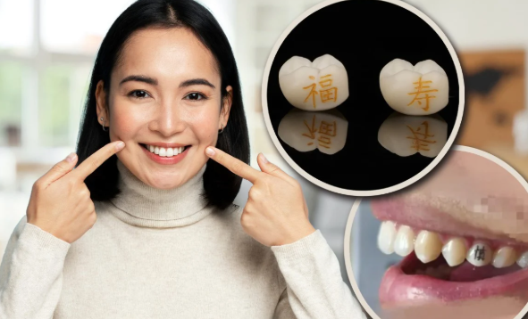 Giới trẻ Trung Quốc khắc chữ "làm giàu", "thành công" ngay trên răng