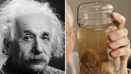Bộ não của Einstein có gì đặc biệt mà bị cướp "trắng trợn" khi ông qua đời?