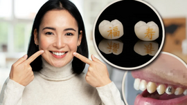 Giới trẻ Trung Quốc khắc chữ "làm giàu", "thành công" ngay trên răng